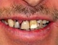 Cosmetic Dentistry