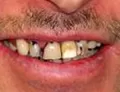 Cosmetic Dentistry